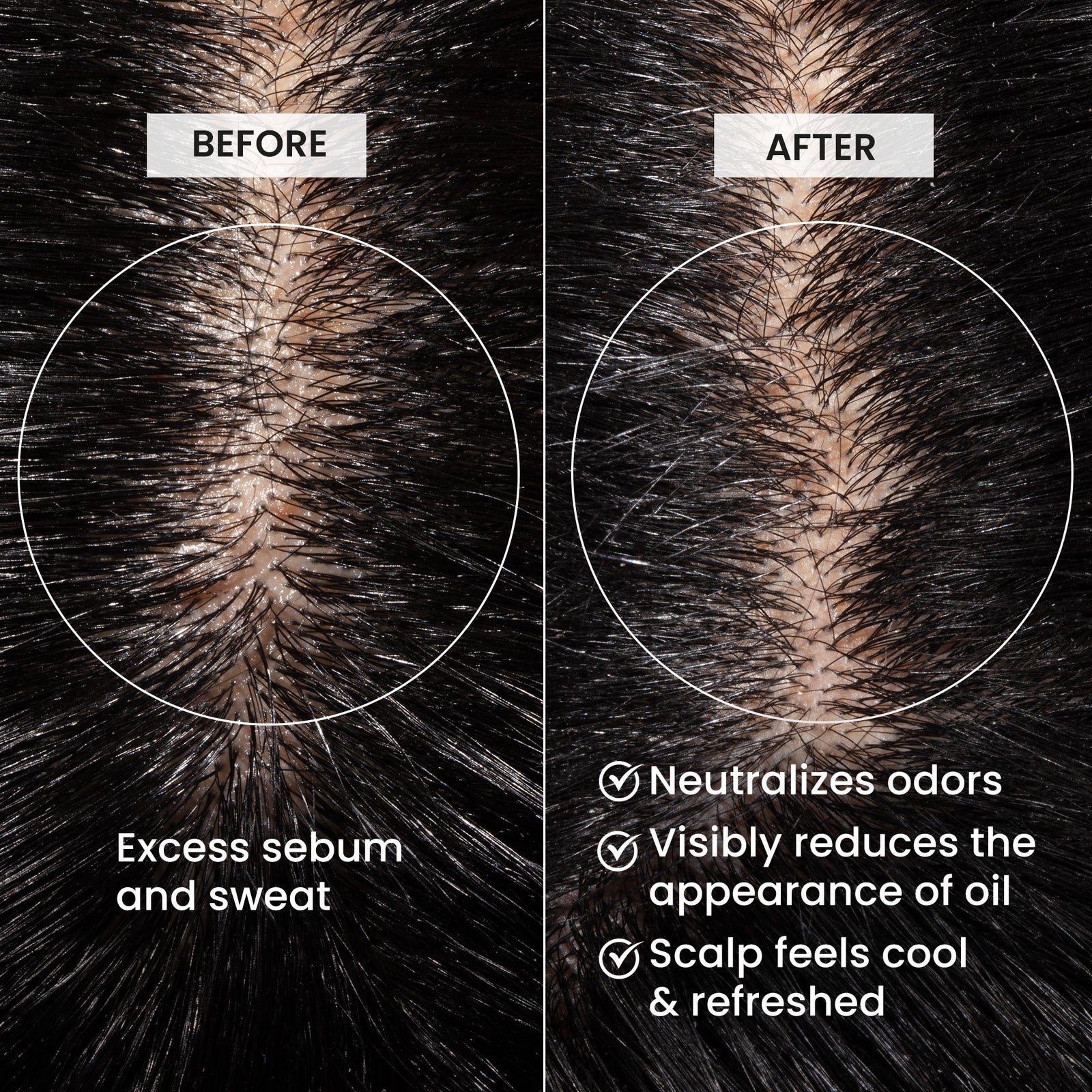 Before and after comparison of scalp with excess sebum and sweat, showing neutralization of odors and reduction of oil., Click to enlarge
